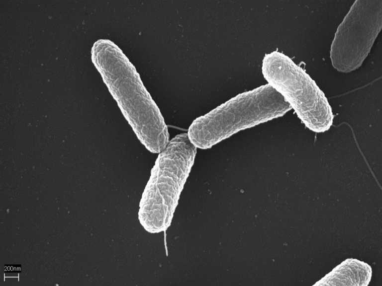Salmonella fundet i luksusmedister